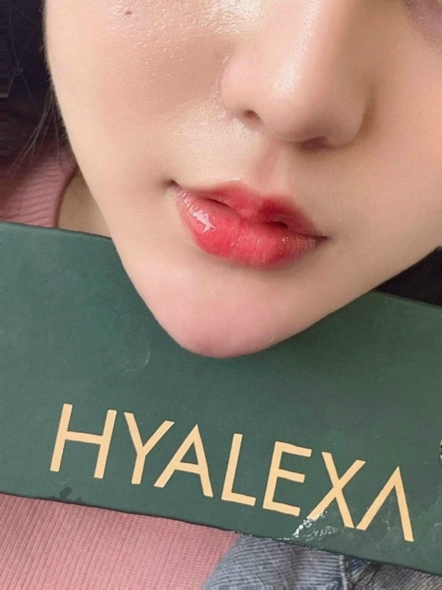 Hiệu quả tạo hình nhanh chóng, không gây đau nhức cho khách hàng Hiệu quả tạo hình nhanh chóng, không gây đau nhức cho khách hàng