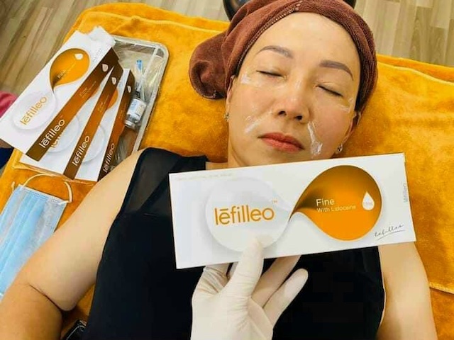 Nhờ kết cấu đặc biệt, filler có khả năng định hình rõ nét, mang đến vẻ đẹp tự nhiên Nhờ kết cấu đặc biệt, filler có khả năng định hình rõ nét, mang đến vẻ đẹp tự nhiên